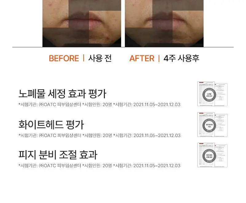 [대용량, 피지/모공케어] 피캄 언더포어 바테카 폼 클렌징 250ml 상세페이지 22
